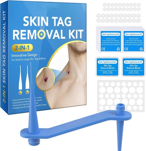 Skin tag removal kit in - removal, kit,