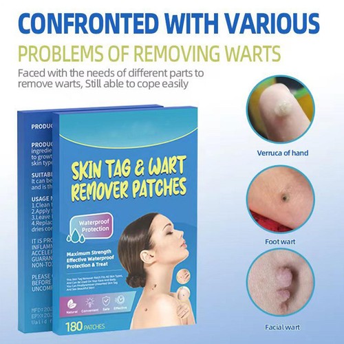 180pcs skin tag - 180pcs, remover