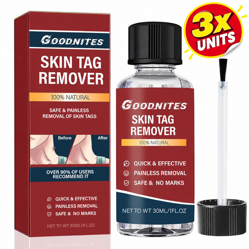 Skin tag remover 30ml - tag,