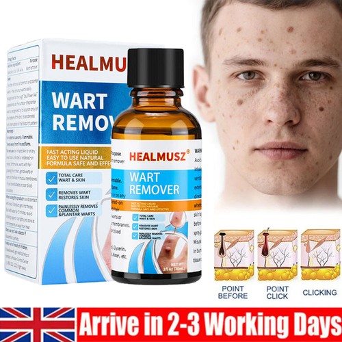 Wart remover liquid skin tags - liquid,