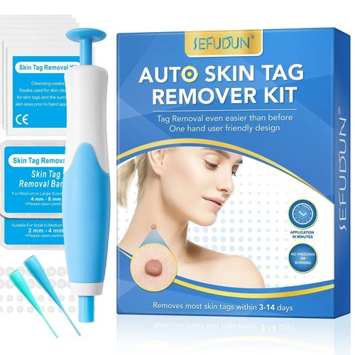 Skin tag removal - removal, natural