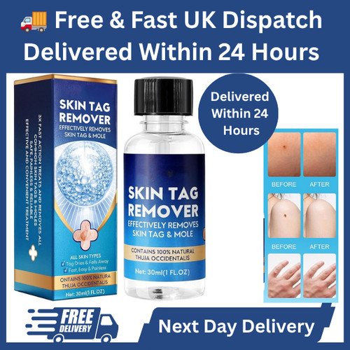Strong skin tag remover - skin,