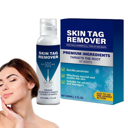60ml mole remover - 60ml, spots