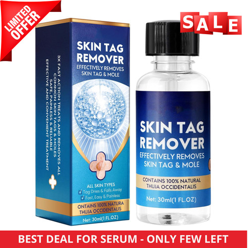 Strong skin tag - skin,