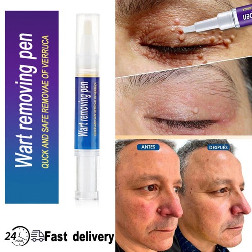 5ml wart remover pen - wart, skin