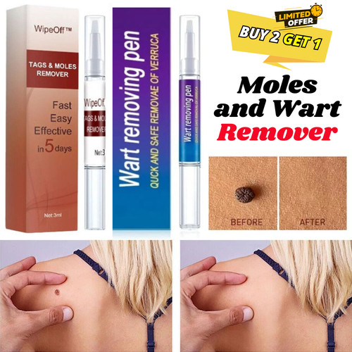 Wipeoff tags moles remover - moles,