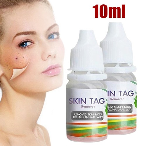 10ml skin tag cure - 10ml,