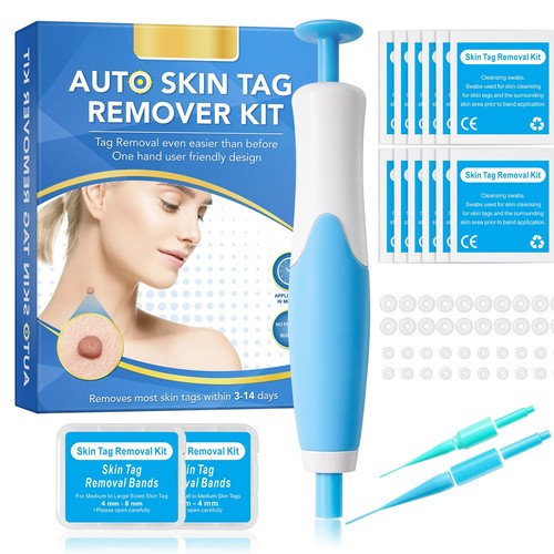Skin tag removal - skin,