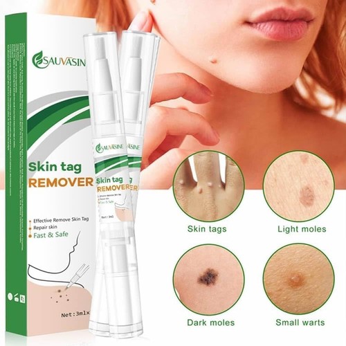 Skin tag wart mole - skin, remover