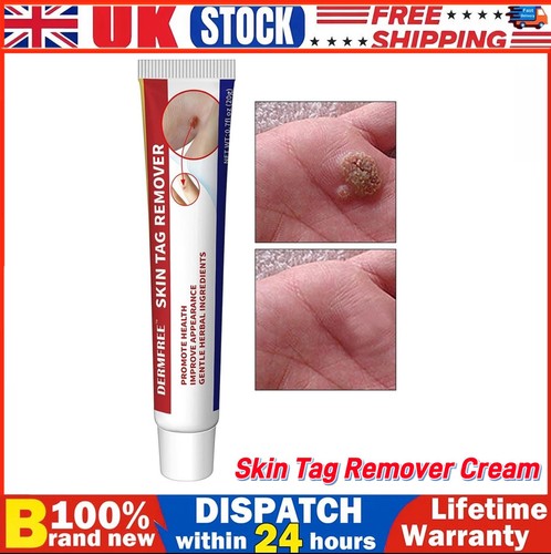 Strong skin tag - strong,
