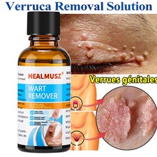 Wart Remover Liquid Skin Tag