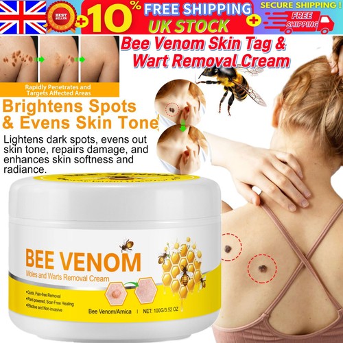 Strong skin tag remover - strong, cream