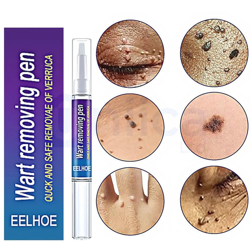 Wart remover pen - remover, tags