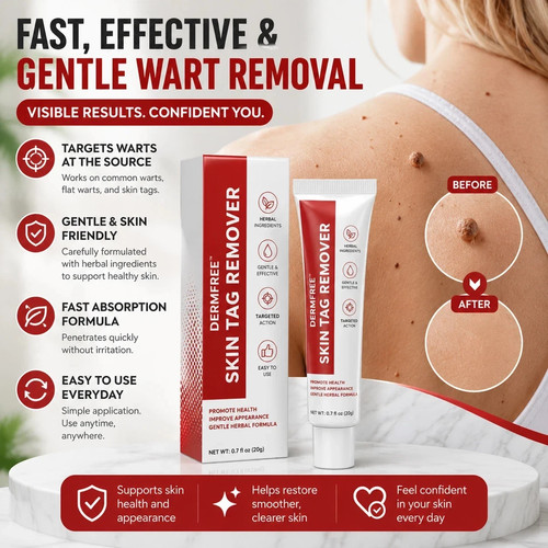 Strong skin tag remover - skin, cream