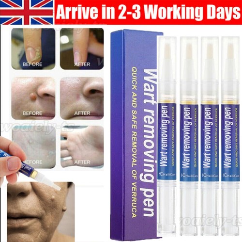 5pc hours wart - hours, remover