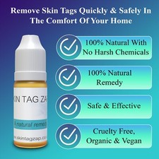 Best Natural Skin Tag Remover