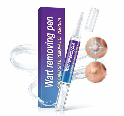 New wart remover - remover, pen