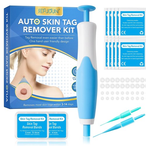 Professional skin tag removal - professional,