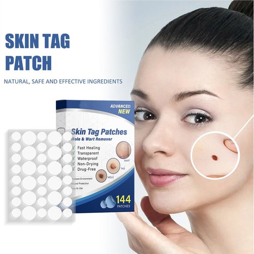 144pcs skin tag remover - 144pcs,