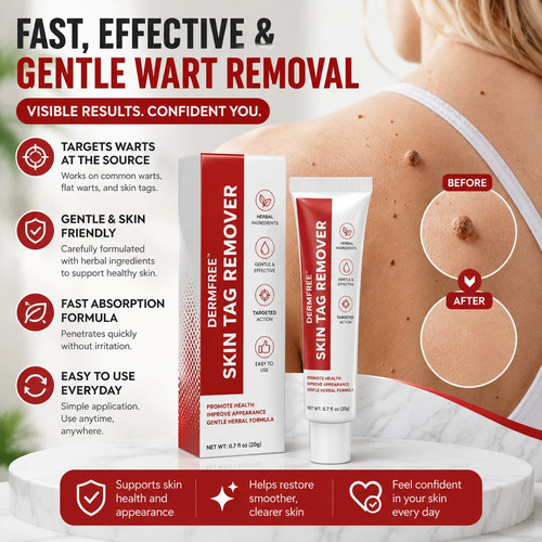 Strong skin tag remover - skin, cream