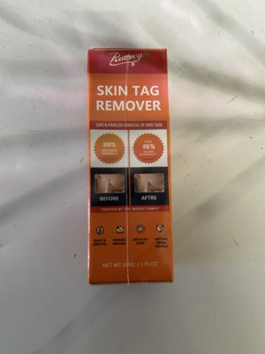 Skin tag remover - skin,