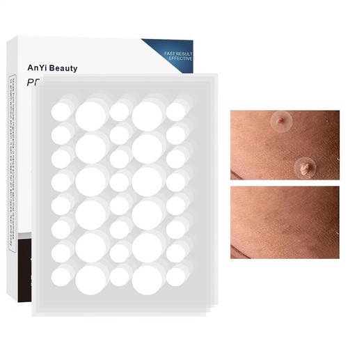 144pcs skin tag - 144pcs,