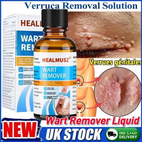 Wart remover liquid - liquid, skin