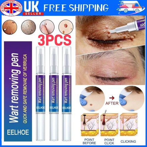 Pack hours wart - 3,