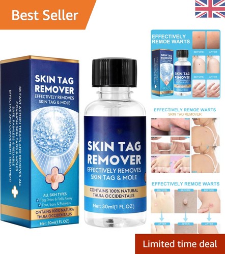 Strong skin tag remover serum - skin,