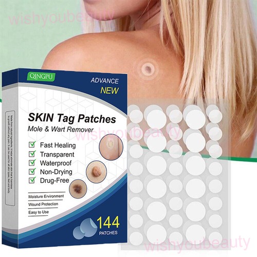 New skin tag - new, remover