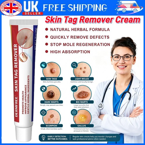 Strong skin tag - tag, cream