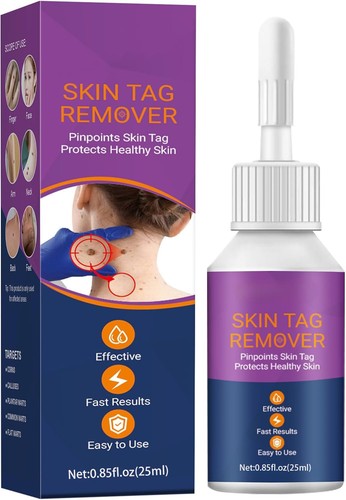 Skin tag remover fast - skin,