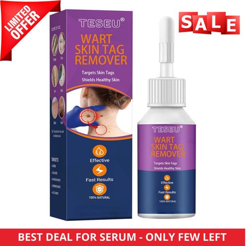 Strong skin tag - skin, serum