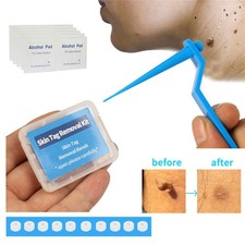 Beauty & Health Skin Tag