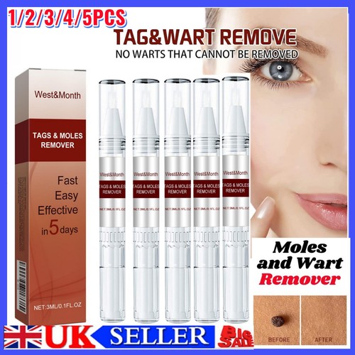 Wart remover liquid skin tag - skin,