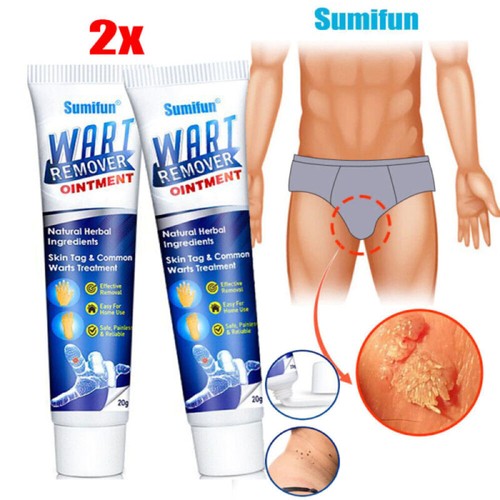Wart remover skin tag - wart,