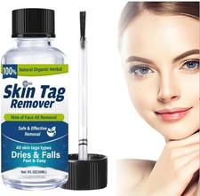 Skin Tag Remover . 100%