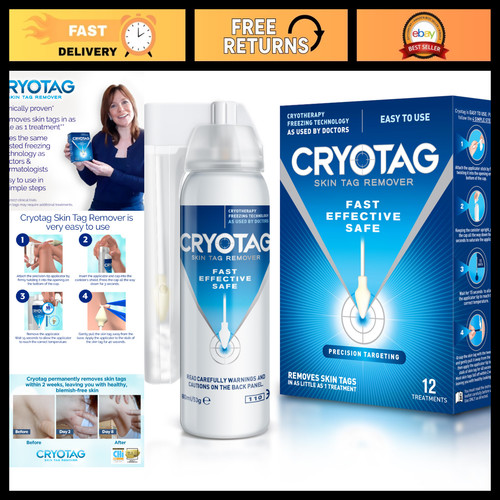 Effective skin tag remover - effective,