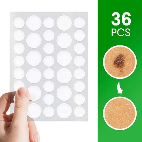 Skin tag removal - removal, patches