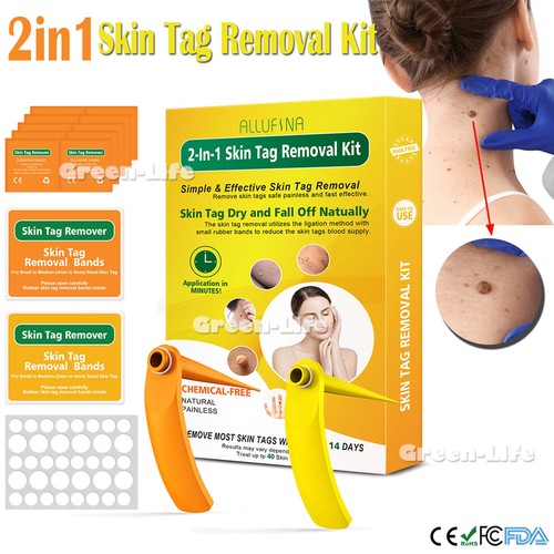 Micro auto skin tag - micro,