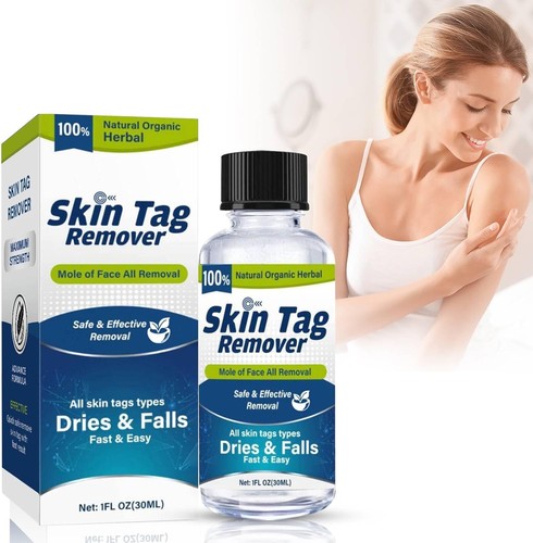 Skin tag remover mole face - skin,