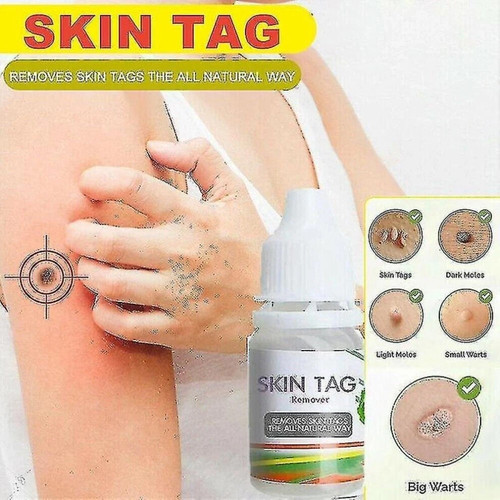 Crazylife skin tag remover - remover, |