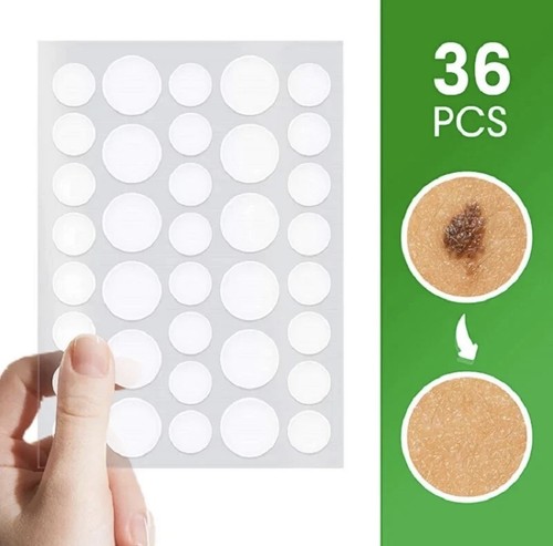 Skin tag removal - tag, patches