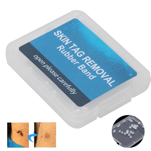 30pcs skin tag removal - skin, non