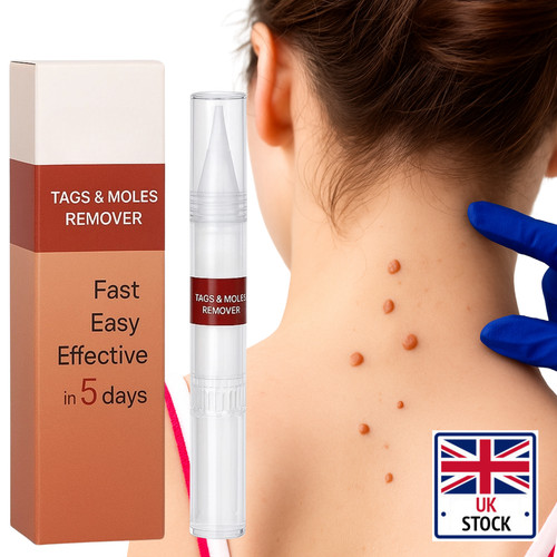 Wart remover liquid skin - remover,