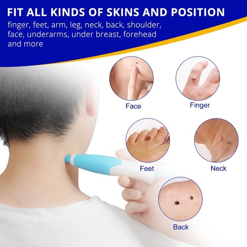 Natural painless auto skin tag - natural,