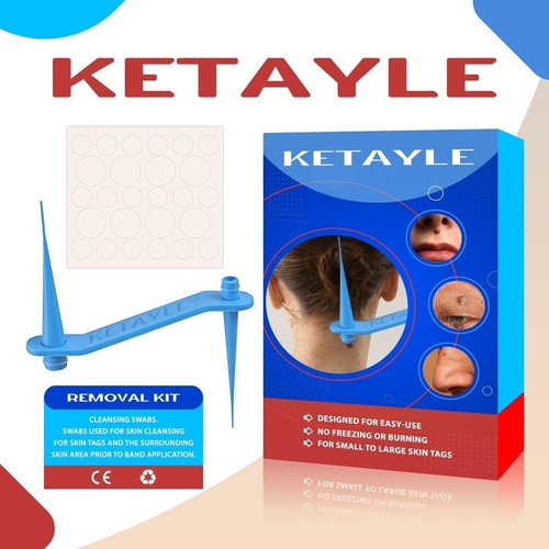 Rubber bands skin tag remover - rubber,