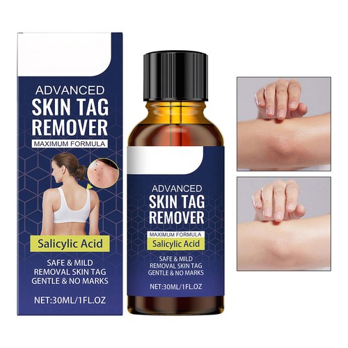 New fast acting skin - new, fast-acting
