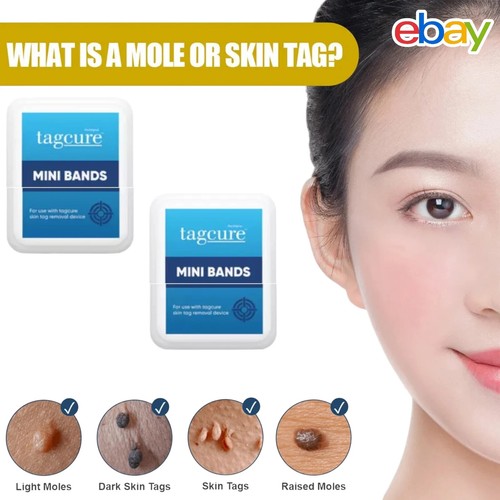 Skin tag removal - skin,