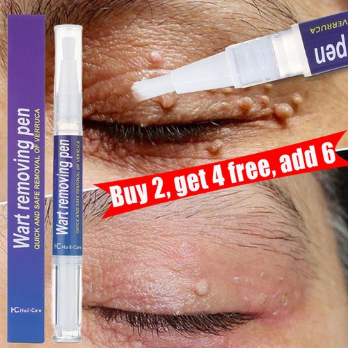 Wart remover pen - remover, tags